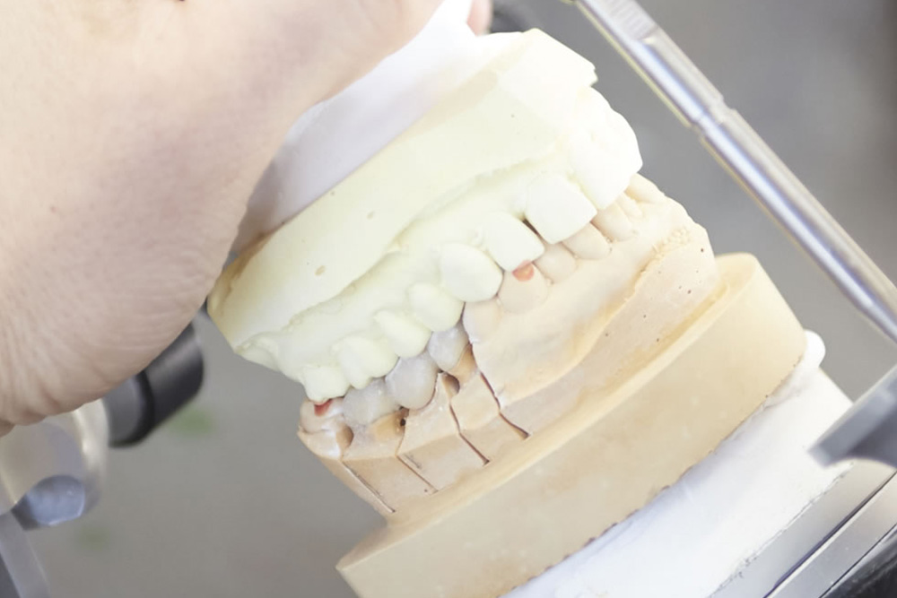 熟練の歯科技工士へ製作を依頼