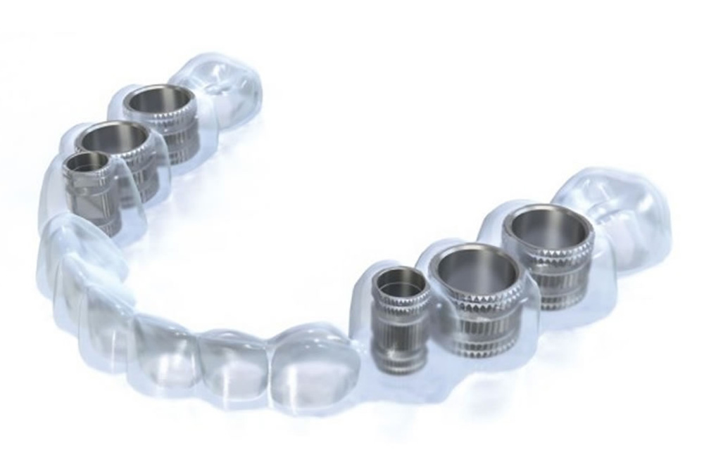 サージカルガイドによるミスの防止