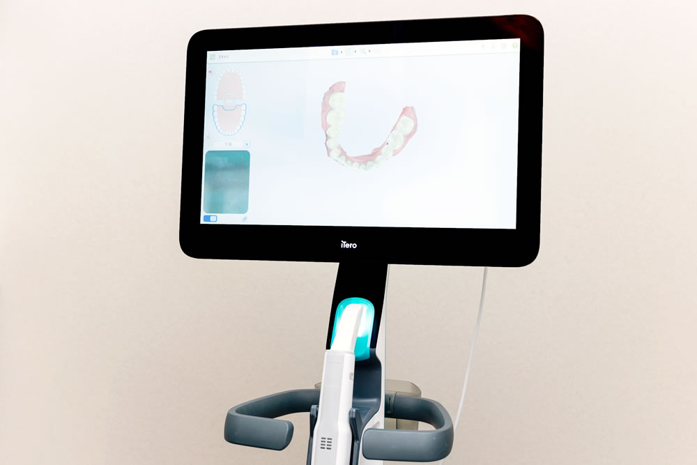 口腔内スキャナーiTero